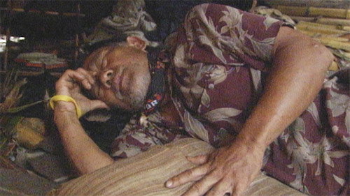 Survivor - S12E11: Medical Emergency